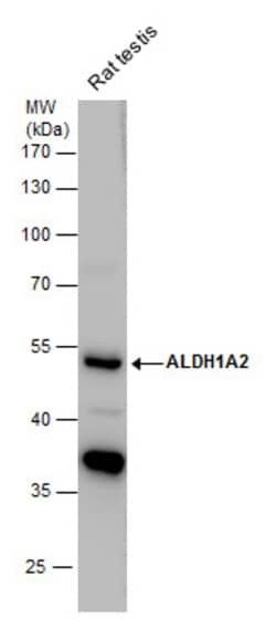 Invitrogen ALDH1A2 Polyclonal Antibody 100 &mu;L | Buy Online | Invitrogen&trade; | Fisher Scientific