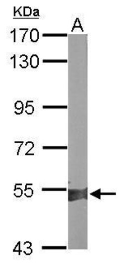 Invitrogen ALDH1A2 Polyclonal Antibody 100 &mu;L | Buy Online | Invitrogen&trade; | Fisher Scientific