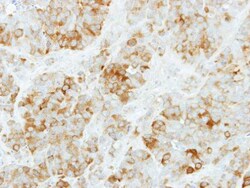 Invitrogen KYNU Polyclonal Antibody 100 μL; Unconjugated:Antibodies,