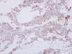 Invitrogen GRAP2 Polyclonal Antibody 100 &mu;L; Unconjugated:Antibodies,