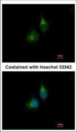 Invitrogen PDIR Polyclonal Antibody 100 &mu;L; Unconjugated:Antibodies,