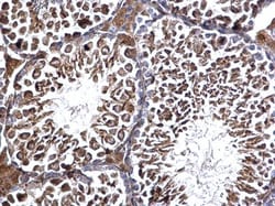EDC3 Polyclonal Antibody:Antibodies, Polyclonal