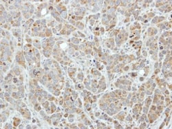 EDC3 Polyclonal Antibody:Antibodies, Polyclonal
