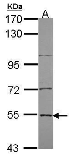 EDC3 Polyclonal Antibody:Antibodies, Polyclonal