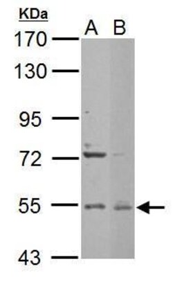 EDC3 Polyclonal Antibody:Antibodies, Polyclonal