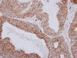 Invitrogen PNPase Polyclonal Antibody 100 &mu;L; Unconjugated:Antibodies,