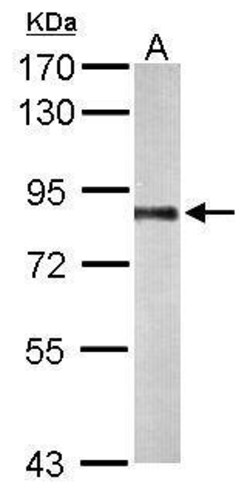 Invitrogen PNPase Polyclonal Antibody 100 &mu;L; Unconjugated:Antibodies,