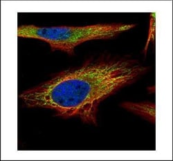 Invitrogen PNPase Polyclonal Antibody 100 &mu;L | Buy Online | Invitrogen&trade; | Fisher Scientific