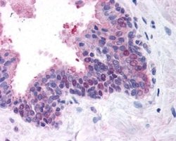 Invitrogen FANCD2 Polyclonal Antibody, HRP 50 &mu;L; HRP:Antibodies, Polyclonal