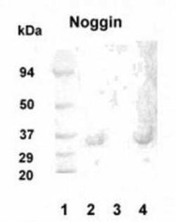 Invitrogen Noggin Polyclonal Antibody 100 &mu;g; Unconjugated:Antistoffer