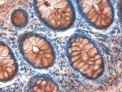 NOTCH4 Polyclonal Antibody, Invitrogen 100 μg; Unconjugated:Antibodies,