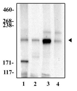 NOTCH4 Polyclonal Antibody, Invitrogen 100 μg; Unconjugated:Antibodies,