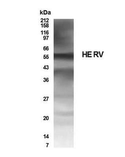Invitrogen HERV Polyclonal Antibody 100 &mu;g; Unconjugated:Antibodies,