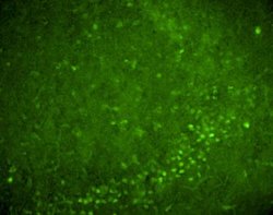 Invitrogen Nurr1 Polyclonal Antibody 100 &mu;g; Unconjugated:Antibodies,