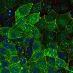 Invitrogen Aquaporin 2 Polyclonal Antibody 100 &mu;L; Unconjugated:Antibodies,