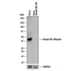 Invitrogen Maspin Polyclonal Antibody 100 &mu;L | Buy Online | Invitrogen&trade; | Fisher Scientific