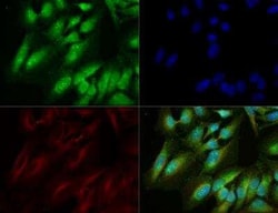 Invitrogen GLUT9 Polyclonal Antibody 100 &mu;L; Unconjugated:Antibodies,