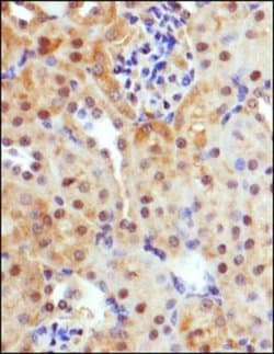 Invitrogen GLUT9 Polyclonal Antibody 100 &mu;L; Unconjugated:Antibodies,