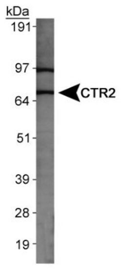 Invitrogen CTR2 Polyclonal Antibody 100 &mu;L; Unconjugated:Antibodies,