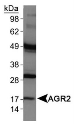 Invitrogen AGR2 Polyclonal Antibody 100 &mu;L; Unconjugated:Antibodies,