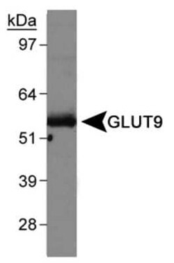 Invitrogen GLUT9 Polyclonal Antibody 100 &mu;L; Unconjugated:Antibodies,