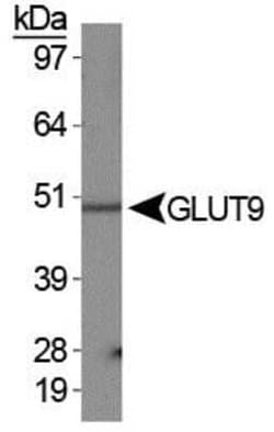 Invitrogen GLUT9 Polyclonal Antibody 100 &mu;L | Buy Online | Invitrogen&trade; | Fisher Scientific