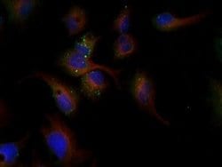 Invitrogen LDLR Polyclonal Antibody 100 &mu;L; Unconjugated:Antibodies,