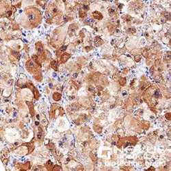 Invitrogen LDLR Polyclonal Antibody 100 &mu;L; Unconjugated:Antibodies,