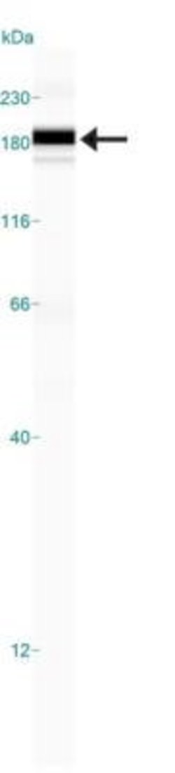Invitrogen LDLR Polyclonal Antibody 100 &mu;L; Unconjugated:Antibodies,