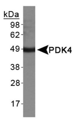 Invitrogen PDK4 Polyclonal Antibody 100 &mu;L; Unconjugated:Anticuerpos
