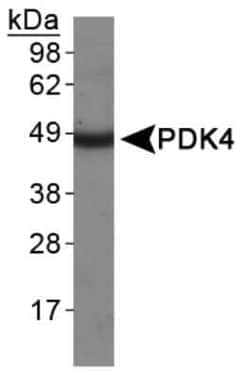 Invitrogen PDK4 Polyclonal Antibody 100 &mu;L; Unconjugated:Anticuerpos