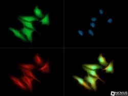 Invitrogen FER Polyclonal Antibody 100 &mu;L; Unconjugated:Antibodies,