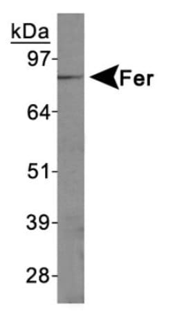 Invitrogen FER Polyclonal Antibody 100 &mu;L; Unconjugated:Antibodies,