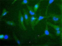 Invitrogen cIAP2 Polyclonal Antibody 100 &mu;L; Unconjugated:Antistoffer