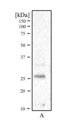 Invitrogen RCAN1 Polyclonal Antibody 100 &mu;L; Unconjugated:Antibodies,