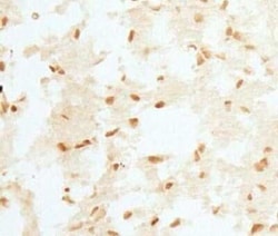 Invitrogen RCAN1 Polyclonal Antibody 100 &mu;L | Buy Online | Invitrogen&trade; | Fisher Scientific