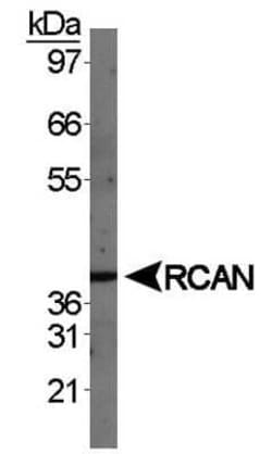 Invitrogen RCAN1 Polyclonal Antibody 100 &mu;L | Buy Online | Invitrogen&trade; | Fisher Scientific
