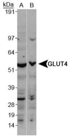 GLUT4 Polyclonal Antibody, Invitrogen 100 &mu;L; Unconjugated:Antibodies,