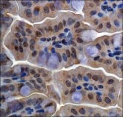 Invitrogen RBBP6 Polyclonal Antibody 100 &mu;L; Unconjugated:Antibodies,