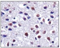 CX3CL1 Polyclonal Antibody, Invitrogen 100 &mu;L; Unconjugated:Antibodies,