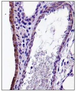 CX3CL1 Polyclonal Antibody, Invitrogen 100 &mu;L; Unconjugated:Antibodies,