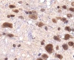 Invitrogen JMJD1A Polyclonal Antibody 100 &mu;L; Unconjugated:Antibodies,