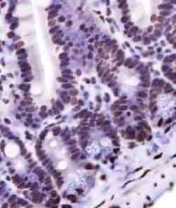Invitrogen Nkx6.1 Polyclonal Antibody 100 &mu;L; Unconjugated:Antibodies,