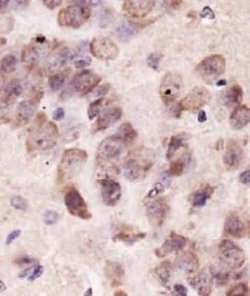 Invitrogen PINK1 Polyclonal Antibody 100 &mu;L; Unconjugated:Antibodies,