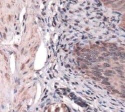 Invitrogen SDHB Polyclonal Antibody 100 &mu;L; Unconjugated:Antibodies,
