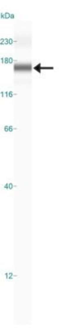 Invitrogen TEK Polyclonal Antibody 100 μL; Unconjugated:Antibodies,