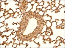 Invitrogen PTCH Polyclonal Antibody 100 &mu;L; Unconjugated:Antibodies,