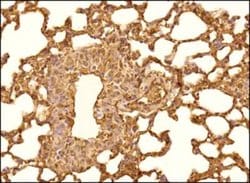 Invitrogen PTCH Polyclonal Antibody 100 &mu;L; Unconjugated:Antibodies,