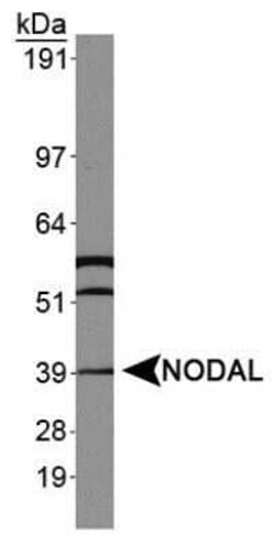 Invitrogen Nodal Polyclonal Antibody 50 &mu;L | Buy Online | Invitrogen&trade; | Fisher Scientific