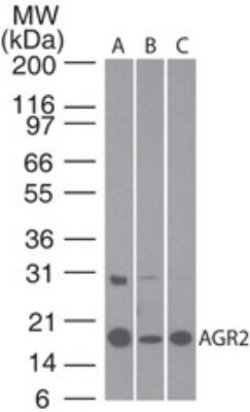 Invitrogen AGR2 Polyclonal Antibody 100 &mu;g; Unconjugated:Antibodies,